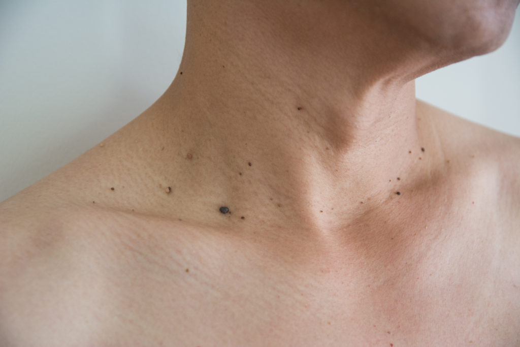 Skin Classic High Frequency