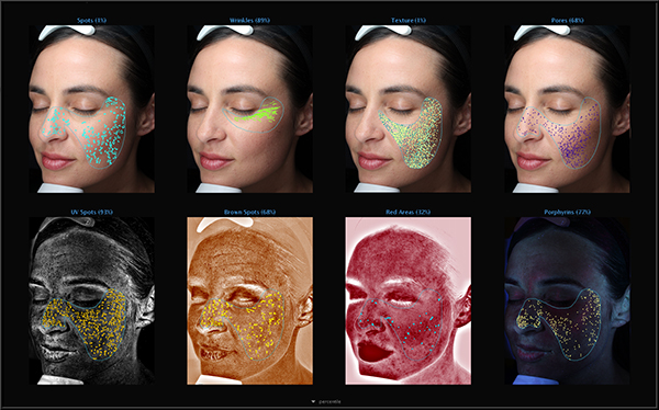Visia Complexion Analysis Overview
