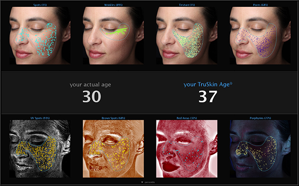 Visia Complexion Analysis TruSkin Age®